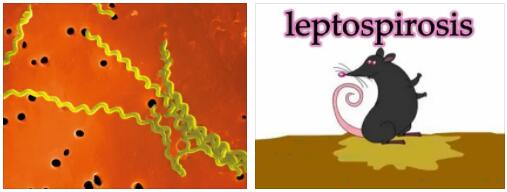 Leptospirosis Explained